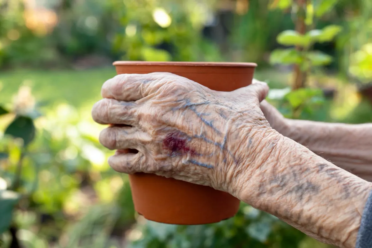 Older man's hands holding a terracotta pot, thin skin with visible veins and a purple patch